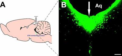 Novel Projections to the Cerebrospinal Fluid-Contacting Nucleus From the Subcortex and Limbic System in Rat